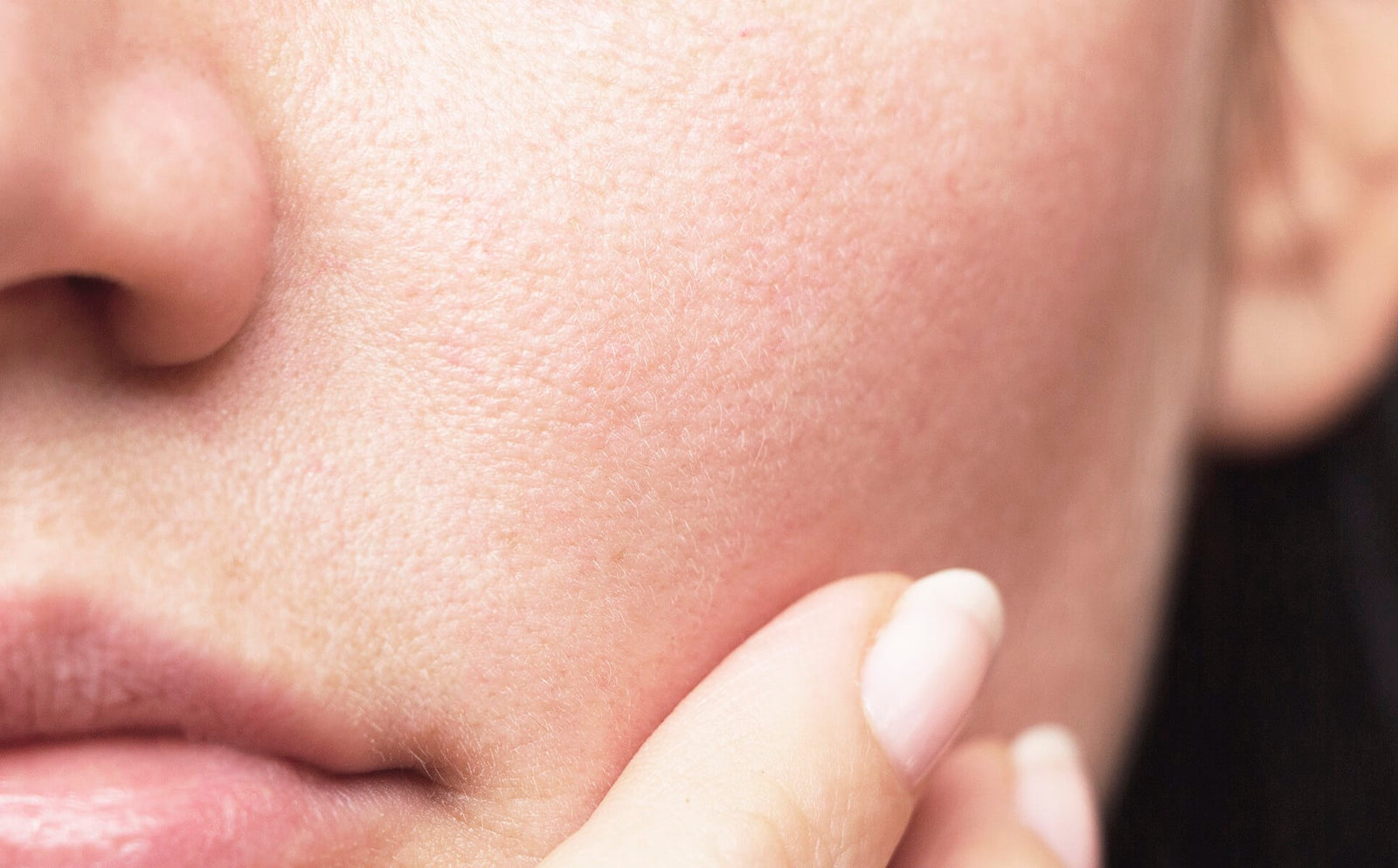 what is dehydrated skin type